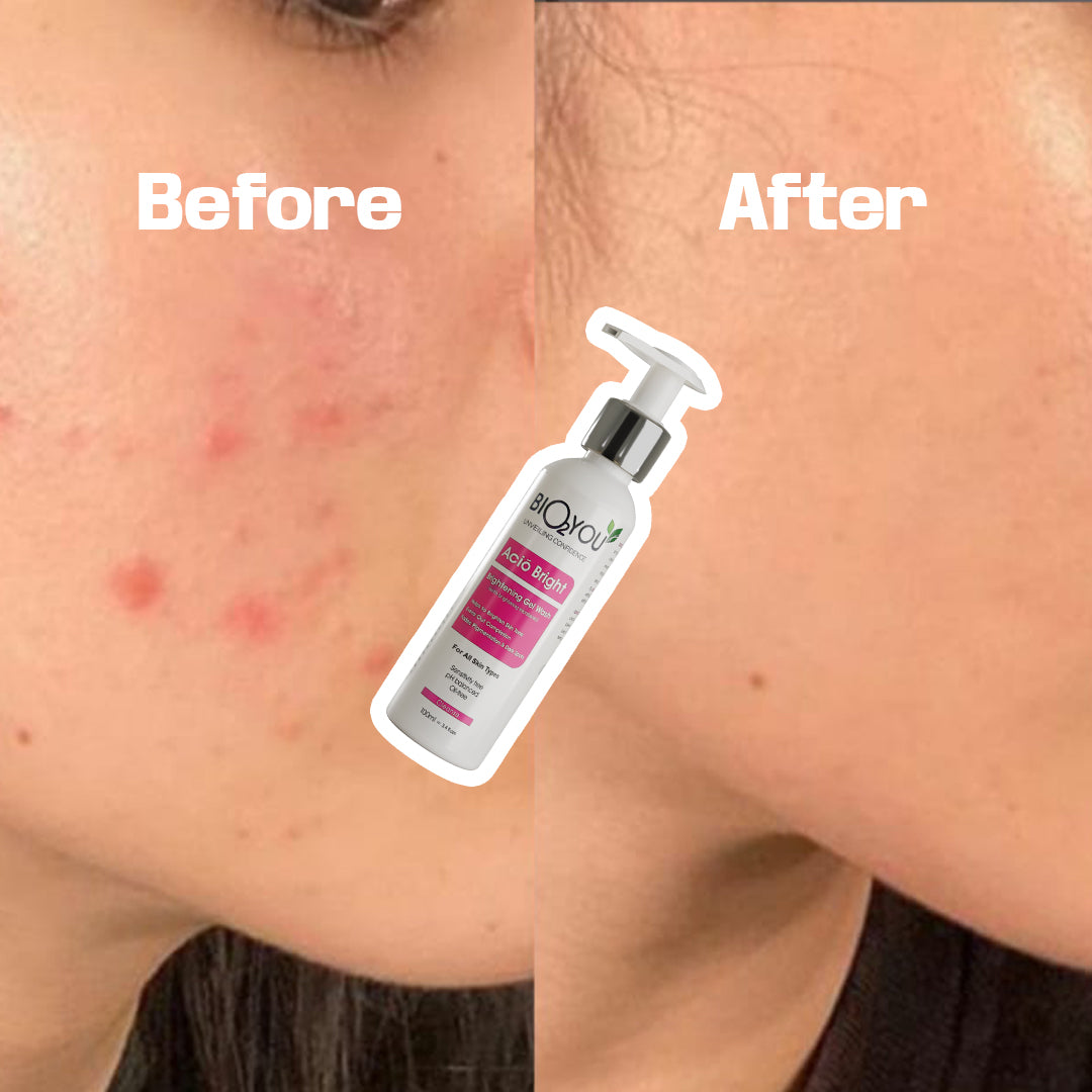 Acio Bright Brightening  Gel Wash